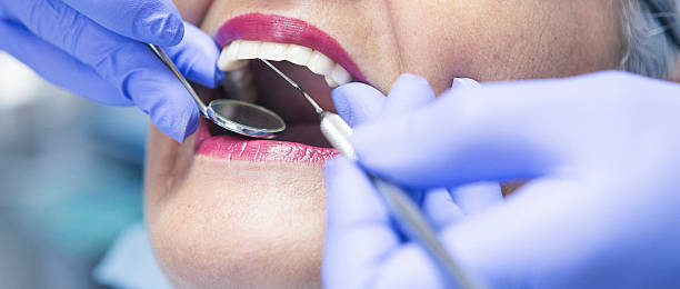 Best Urgent Care for Lost Fillings or Crowns in Cumberland, MD